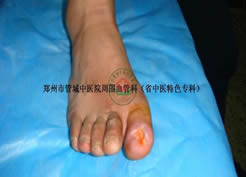 王某出院了，被病痛折磨了八个月的他