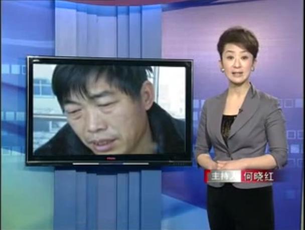 《科技之光》报道我科脉管炎病例《截趾之痛》