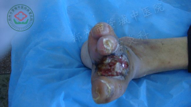 入院时的照片2