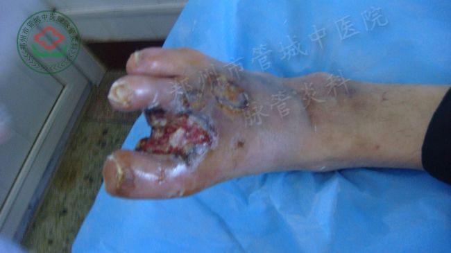 入院时的照片1