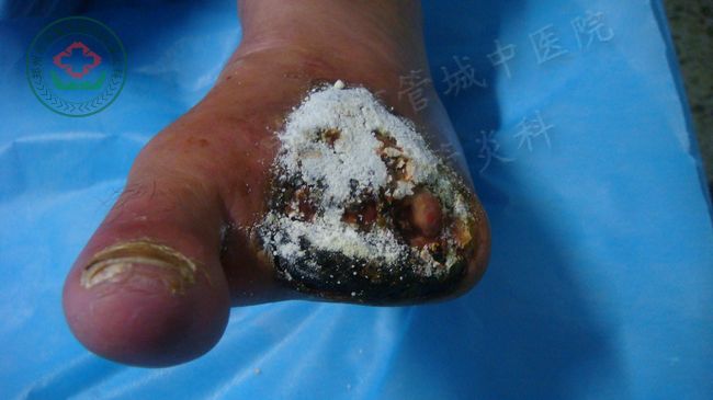 入院时的照片2